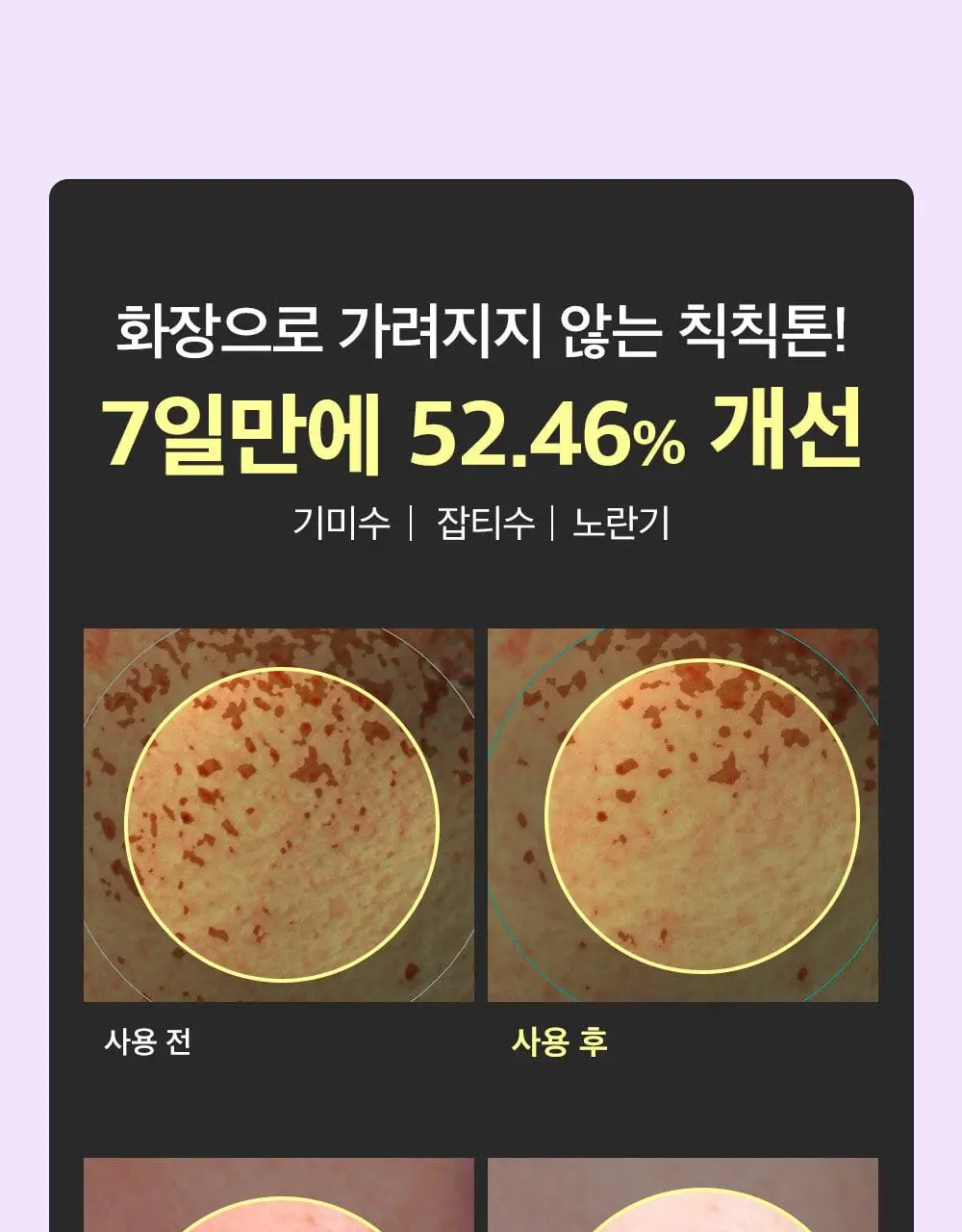 [포켓몬 에디션/잡티미백]성분에디터 머루포도 비타씨 다크 스팟 앰플 40ml 더블기획* 상세페이지 14